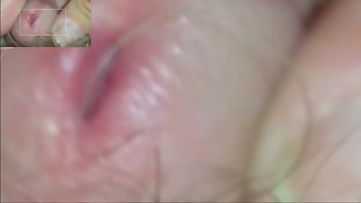 SLIDESHOW: My Buddy Drops A Rock Down My Pisstube By Himself, Old And Young, Gay, BDSM