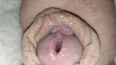 Gaped Urethra (10MM), Amateur, Masturbating, Gay