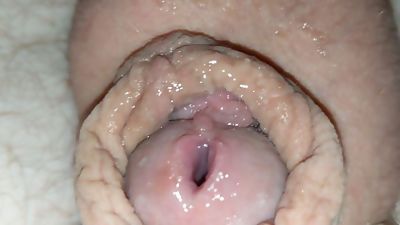 Gaped Urethra (10MM), Amateur, Masturbating, Gay